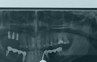 dental-xray-viewed-dentist